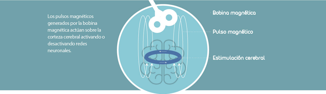 ¿La neuromodulación no invasiva es segura y eficiente?